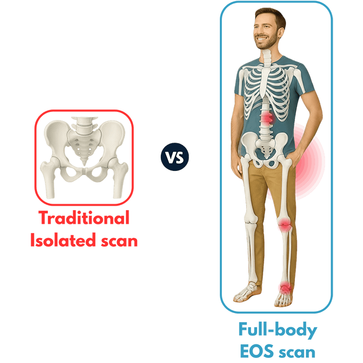 EOS hip imbalance scan